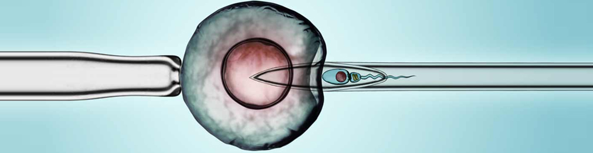 ICSI - Intracytoplasmic Sperm Injection